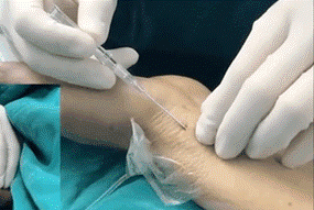 病人监测仪怎么看